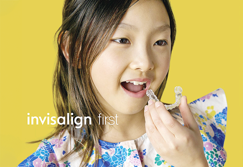 インビザライン・ファースト