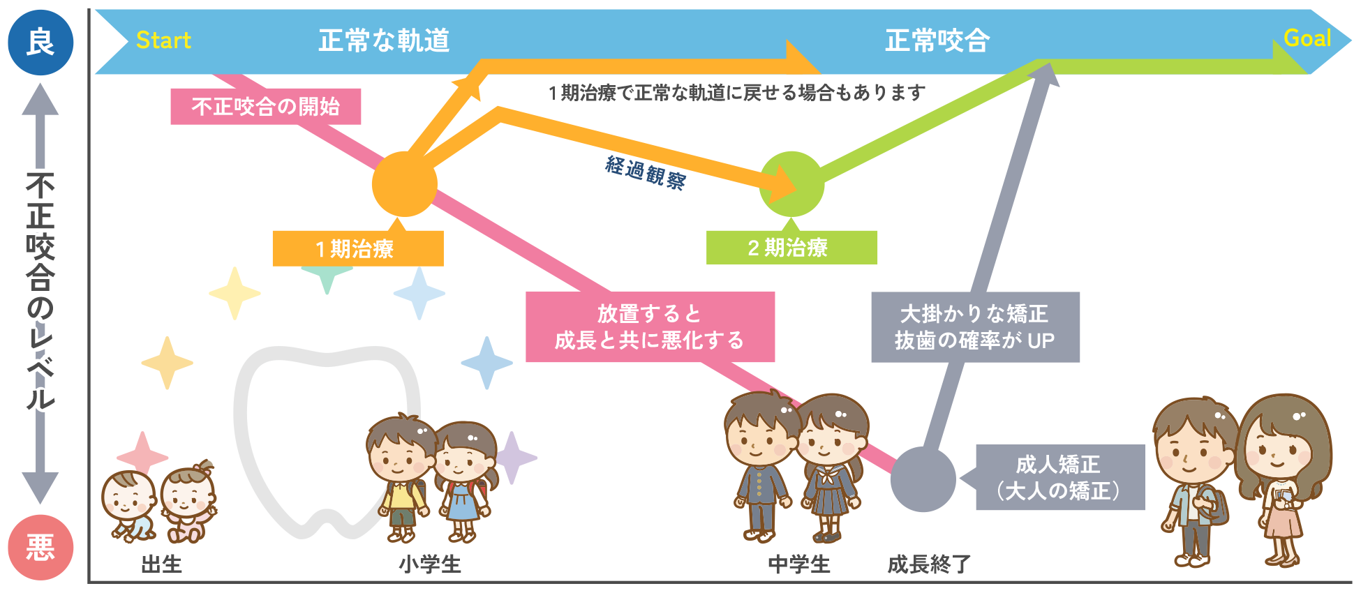 小児矯正歯科の治療の流れ