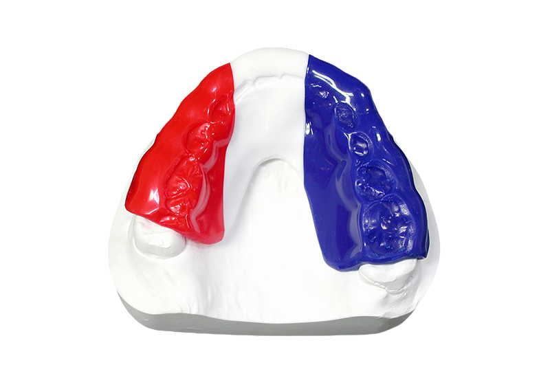 スポーツマウスピース