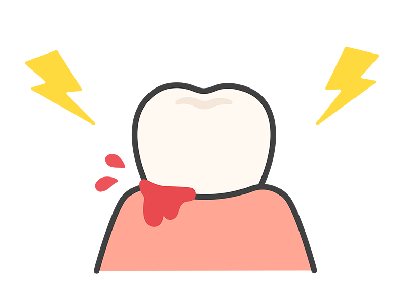 虫歯、歯周病の予防にも