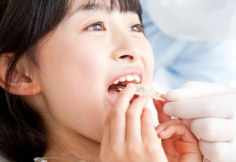 小児矯正歯科について