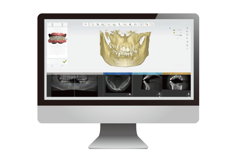診断・シミュレーション