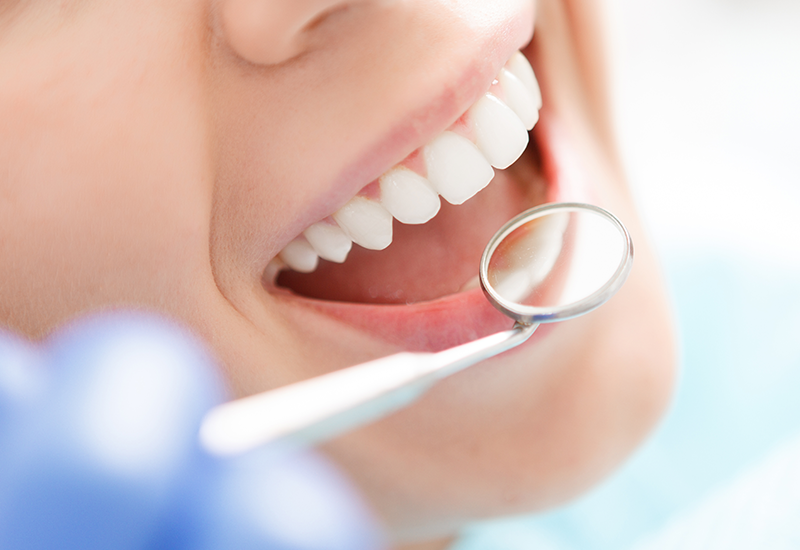 治療後のメンテナンス