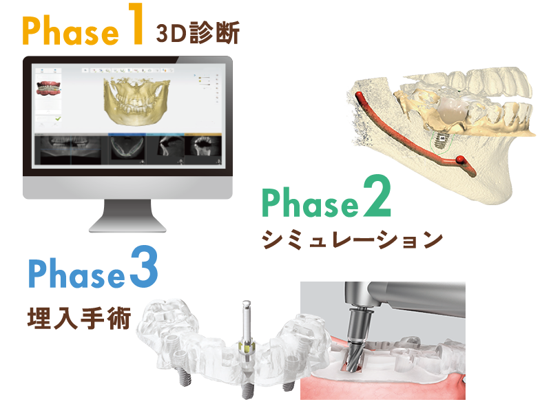 オステムワンガイド