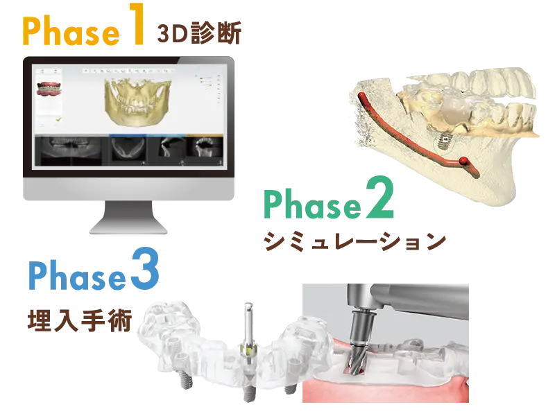 オステムワンガイド