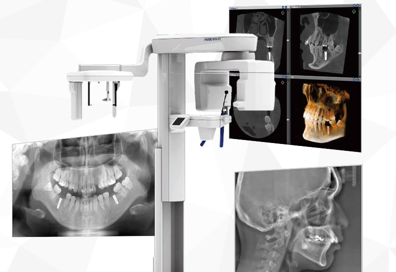 デジタル技術による精密診断
