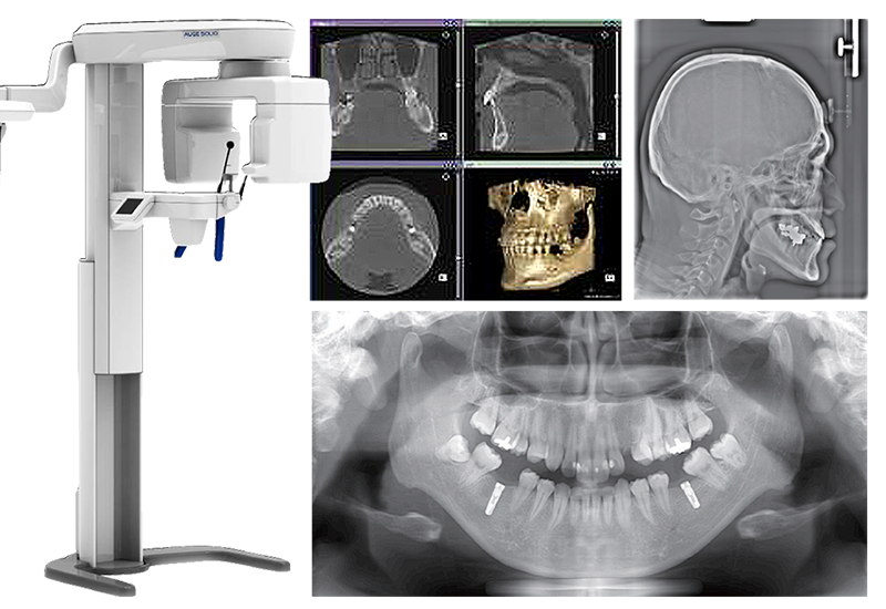 矯正治療検査・診断