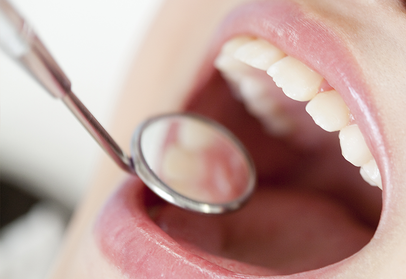 治療終了・保定期間