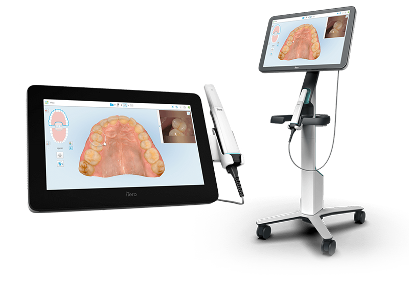 口腔内スキャナー「iTero」