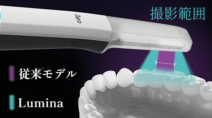 スキャン時間はわずか数分