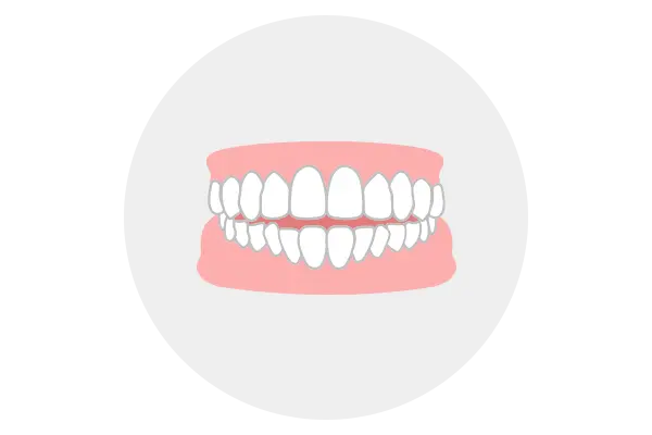 開咬