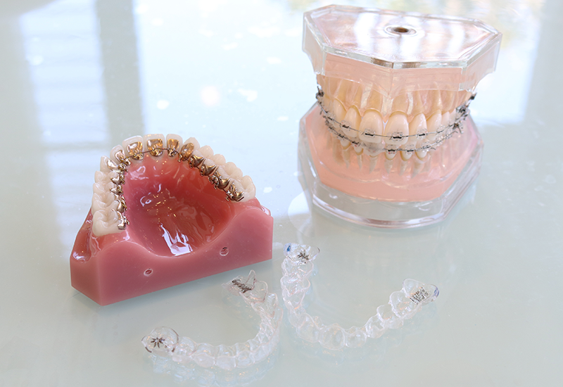 ワイヤー矯正にも対応