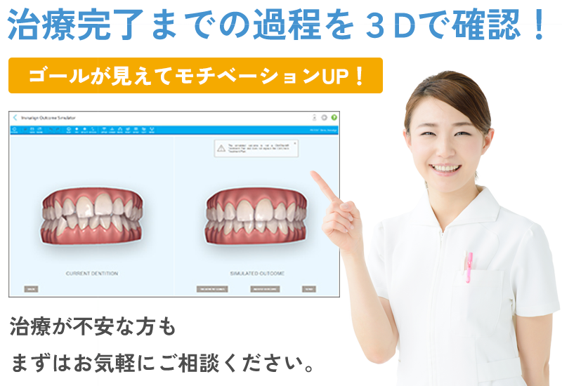 アウトカムシミュレーター