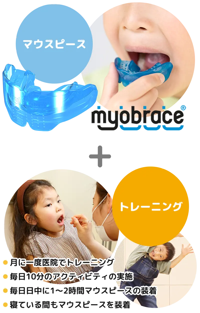 マイオブレースシステム
